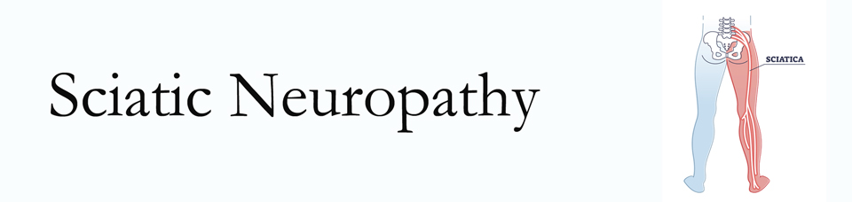 Auburn neuropathy pain (sciatica) 